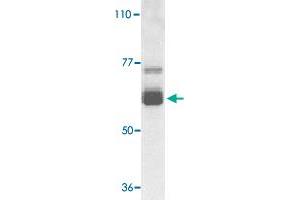 Western blot analysis of IL22RA1 expression in human HepG2 cell lysate with IL22RA1 polyclonal antibody  at 1 ug /mL .
