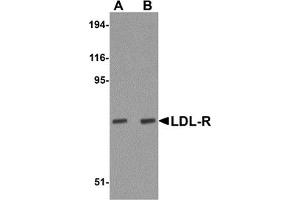 Western Blotting (WB) image for anti-Low Density Lipoprotein Receptor (LDLR) (Middle Region) antibody (ABIN1030978)