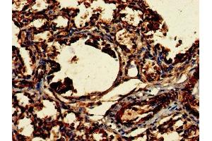 Immunohistochemistry of paraffin-embedded human lung tissue using ABIN7147821 at dilution of 1:100 (Clarin 2 Antikörper  (AA 31-100))