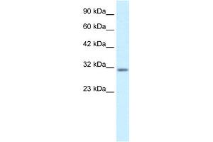 WB Suggested Anti-BARX1 Antibody Titration:  0. (BARX1 Antikörper  (Middle Region))