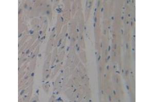 Used in DAB staining on fromalin fixed paraffin- embedded Kidney tissue (SIRPB1 Antikörper  (AA 129-342))