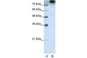 WB Suggested Anti-EIF3S9  Antibody Titration: 0. (EIF3B Antikörper  (C-Term))