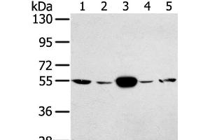 Western Blot analysis of Hela and K562 cell, Human fetal muscle tissue, A375 and hepg2 cell using TRIM35 Polyclonal Antibody at dilution of 1:400 (TRIM35 Antikörper)