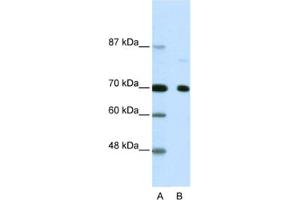 Western Blotting (WB) image for anti-Nuclear Receptor Co-Repressor 2 (NCOR2) antibody (ABIN2460476) (NCOR2 Antikörper)