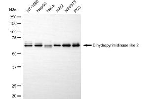 Western blotting analysis using dihydropyrimidinase like 2 antibody (ABIN7798337). (Rekombinanter DPYSL2 Antikörper)