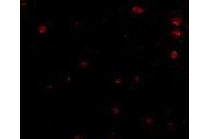 Immunofluorescence of human brain tissue using AP30335PU-N FEZ2 antibody at 5 μg/ml. (FEZ2 Antikörper  (Center))