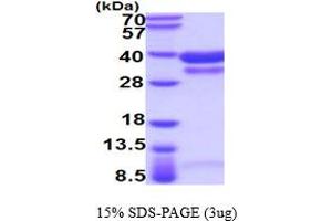 Cathepsin B Protein (CTSB) (AA 18-339) (His tag)