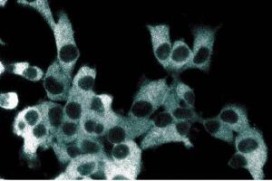 Immunofluorescent staining of ES2 cells with anti-IKKgamma antibody. (IKBKG Antikörper  (AA 278-396))