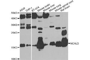 Western blot analysis of extracts of various cell lines, using NCALD antibody. (NCALD Antikörper)