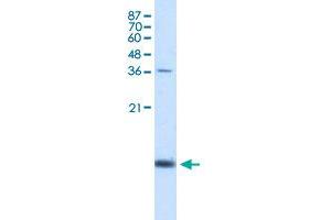 Western Blot analysis of K562 cell lysate with HBZ polyclonal antibody  at 1.