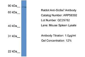 Western Blotting (WB) image for anti-Sodium Hydrogen Exchanger 7 (SLC9A7) (C-Term) antibody (ABIN2787660)