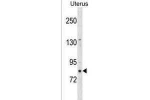 ZN Antibody (N-term) (ABIN1539004 and ABIN2850297) western blot analysis in Uterus tissue lysates (35 μg/lane). (ZNF853 Antikörper  (N-Term))