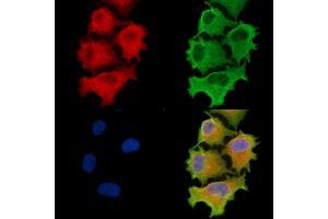 ABIN6260768 and ABIN6279276 staining  cells by IF/ICC. (CEP41 Antikörper  (Internal Region))