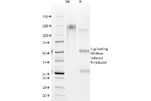SDS-PAGE Analysis Purified HSA Mouse Monoclonal Antibody (HSA98). (Hepatocyte Specific Antigen Antikörper)