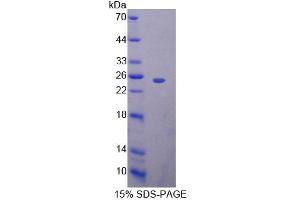 SDS-PAGE (SDS) image for BCL2-Associated Athanogene 5 (BAG5) (AA 1-172) protein (His tag) (ABIN6239581) (BAG5 Protein (AA 1-172) (His tag))