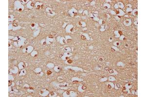 IHC image of ABIN7166521 diluted at 1:300 and staining in paraffin-embedded human brain tissue performed on a Leica BondTM system. (PCDHa8 Antikörper  (AA 719-922))