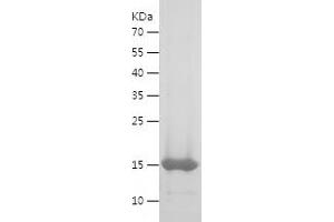 Western Blotting (WB) image for Calprotectin (S100A8/A9) (AA 1-119) protein (His tag) (ABIN7122108) (Calprotectin Protein (S100A8/A9) (AA 1-119) (His tag))