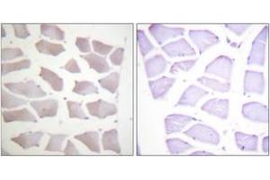 Immunohistochemistry analysis of paraffin-embedded human skeletal muscle tissue, using CRYAB (Ab-19) Antibody. (CRYAB Antikörper  (AA 10-59))