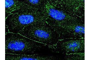 This image was generously provided by Piotr Mamczur at University of Wroclaw.