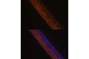 Immunofluorescence analysis of mouse eye using MYH13 Polyclonal Antibody (ABIN7268746) at dilution of 1:100 (40x lens).