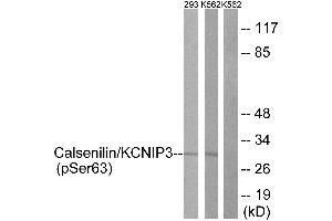 Immunohistochemistry analysis of paraffin-embedded human brain tissue using Calsenilin/KCNIP3 (Phospho-Ser63) antibody.