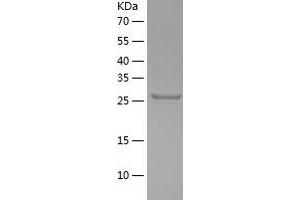 Western Blotting (WB) image for OTU Domain Containing 6B (OTUD6B) (AA 1-293) protein (His tag) (ABIN7124280) (OTUD6B Protein (AA 1-293) (His tag))