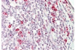 Rabbit Anti-KIAA0317 antibody  Formalin Fixed Paraffin Embedded Tissue: Human Tonsil Primary antibody Concentration: 1:100 Secondary Antibody: Donkey anti-Rabbit-Cy3 Secondary Antibody Concentration: 1:200 Magnification: 20x Exposure Time: 0. (AREL1 Antikörper  (N-Term))