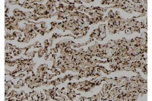 ABIN6272402 at 1/100 staining Human lung tissue by IHC-P.