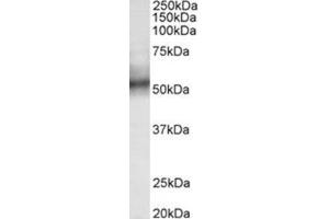 AP31785PU-N TRIM11 antibody staining of Human spleen lysate at 0. (TRIM11 Antikörper  (Internal Region))