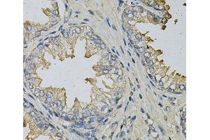 Immunohistochemistry of paraffin-embedded Human prostate using LITAF Polyclonal Antibody at dilution of 1:100 (40x lens). (LITAF Antikörper)