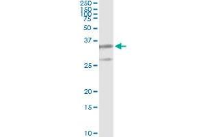 Western Blotting (WB) image for anti-Proteasome (Prosome, Macropain) Subunit, beta Type, 8 (Large Multifunctional Peptidase 7) (PSMB8) (AA 173-272) antibody (ABIN562483)