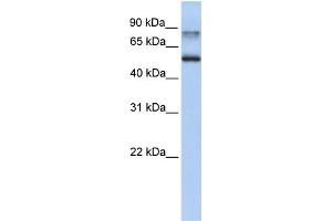 WB Suggested Anti-EPN1 Antibody Titration: 0. (Epsin 1 Antikörper  (C-Term))