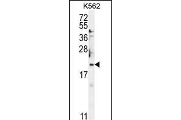 BTG2 Antikörper  (N-Term)