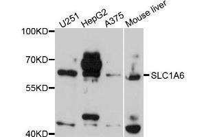 Western blot analysis of extracts of various cells, using SLC1A6 antibody. (SLC1A6 Antikörper)