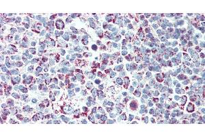 Immunohistochemistry of paraffin-embedded Tonsil tissue using LTB Polyclonal Antibody at dilution of 1:90. (LTB Antikörper)