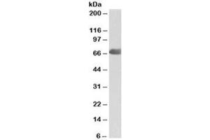 Western blot testing of human placenta lysate with C9 antibody at 2ug/ml. (C9 Antikörper)