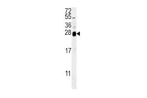 ZN Antibody (C-term) (ABIN651881 and ABIN2840437) western blot analysis in  cell line lysates (35 μg/lane). (RNF114 Antikörper  (C-Term))