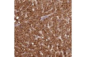 Immunohistochemical staining of human liver with C16orf46 polyclonal antibody  shows strong cytoplasmic positivity in hepatocytes. (C16ORF46 Antikörper)