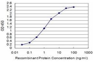 Detection limit for recombinant GST tagged SIX4 is approximately 0. (SIX4 Antikörper  (AA 672-780))