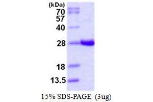 Image no. 1 for Glutathione S-Transferase alpha 4 (GSTA4) protein (His tag) (ABIN1098254)