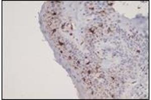 Immunohistochemistry (IHC) image for anti-CD1a (CD1a) (C-Term) antibody (ABIN870503) (CD1a Antikörper  (C-Term))