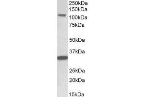 ABIN2561660 (1µg/ml) staining of Human Hippocampus lysate (35µg protein in RIPA buffer). (KIT Antikörper  (Internal Region))