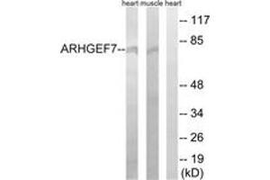 Western blot analysis of extracts from rat muscle/rat heart cells, using ARHGEF7 Antibody. (ARHGEF7 Antikörper  (AA 311-360))