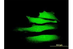 Immunofluorescence (IF) image for anti-SWI/SNF Related, Matrix Associated, Actin Dependent Regulator of Chromatin, Subfamily A, Member 2 (SMARCA2) (AA 659-735) antibody (ABIN520280)