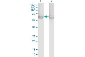 Western Blot analysis of PRKAA1 expression in transfected 293T cell line by PRKAA1 MaxPab polyclonal antibody.
