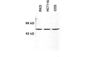 Image no. 1 for anti-Checkpoint Kinase 1 (CHEK1) (AA 1-474) antibody (ABIN264916) (CHEK1 Antikörper  (AA 1-474))