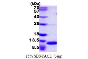 SDS-PAGE (SDS) image for S100 Calcium Binding Protein A8 (S100A8) (AA 1-89) protein (His tag) (ABIN667469) (S100A8 Protein (AA 1-89) (His tag))