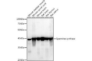 Western blot analysis of extracts of various cell lines, using (ABIN7270529) at 1:1000 dilution. (SMS Antikörper)
