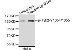 Western blot analysis of extracts of HeLa cells, using Phospho-Tyk2-Y1054/1055 antibody. (TYK2 Antikörper)
