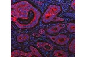 IF analysis of Cytokeratin 20/Krt20 using anti-Cytokeratin 20/Krt20 antibody (ABIN7601133). (KRT20 Antikörper  (AA 29-431))